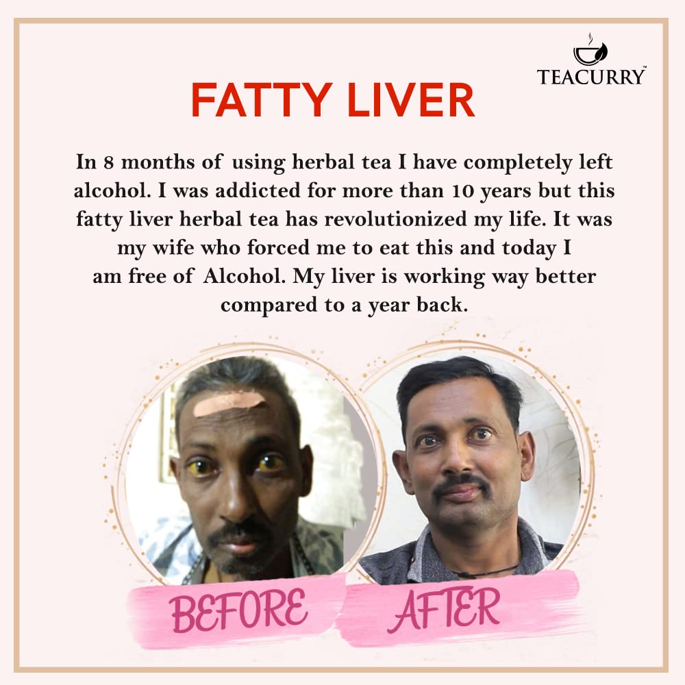 TEACURRY Fatty Liver Tea (1 Month Pack | 30 Tea Bags) - Helps With Fatty Liver Detox, 60 Grams (FROM INDIA) SAB - View 4 of 7