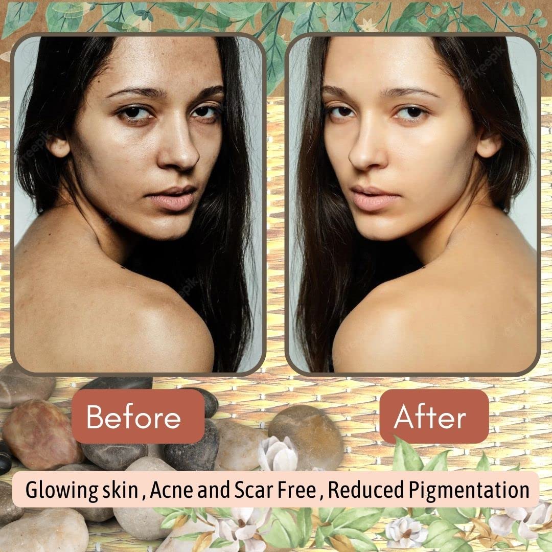 Hindya Ayurvedic Luxury Multani Mitti Powder for Face Pack | 100% Natural Multani Mitti powder for Face, Skin and Hair| Healing Clay | Fuller's Earth | Bentonite Clay 200g - View 3 of 3