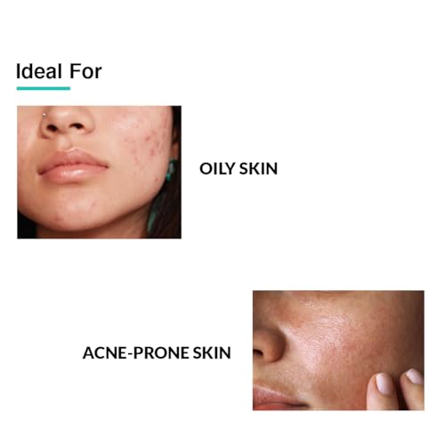Fixderma 2% Salicylic Acid Serum for Anti Acne &amp; Spot Treatment with 5% Azelaic Acid &amp; 4% Mandelic Acid | Anti Acne Face Serum | Face Serum for Men &amp; Women | Face Serum for Oily Skin - 15g - View 3 of 3
