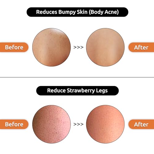OG BEAUTY NATURAL Citraboost Vitamin C Body Lotion 250 Ml - Hydrating and Brightening Formula(fFROM INDIA)NUZ - View 4 of 5