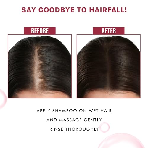 OG BEAUTY NATURAL Onion &amp; Plant Keratin Shampoo 250 Ml - Sulfate-Free, Reduce Hair Loss, Prevent Split Ends, Enhance Strength, Nourish Hair, No Toxins, Men &amp; Women(fFROM INDIA)NUZ - View 4 of 5