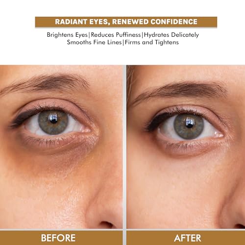 OG BEAUTY SCIENCE Under Eye Face Serum 30 Ml(fFROM INDIA)NUZ - View 4 of 4