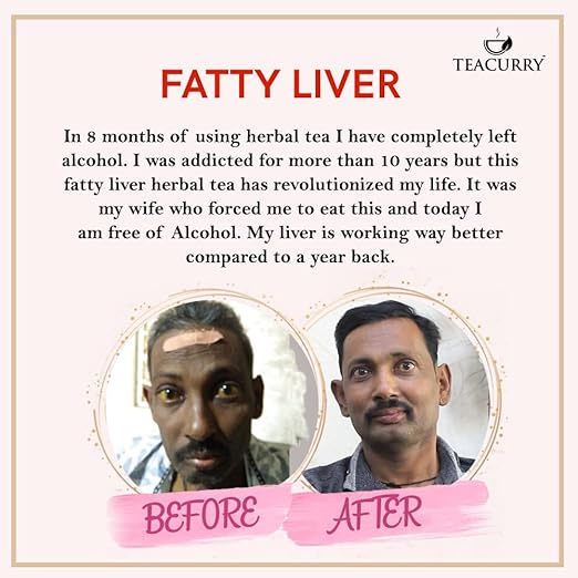 TEACURRY Fatty Liver Tea (1 Month Pack, 30 Tea Bags) - Helps With Fatty Liver Detox, Ginger, 60 Gms - View 6 of 6