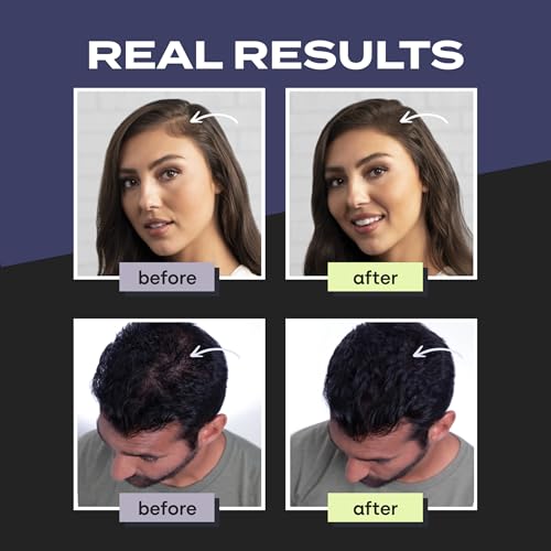 Toppik Hair Building Fibers with Premium Keratin Fibers Conceals Hair Thinning and Hair Loss for Fuller Looking Hair that Gives Completely Natural Look For Men and Women Gray, 12 GramsFROM DUBAI(SAM) - View 3 of 7