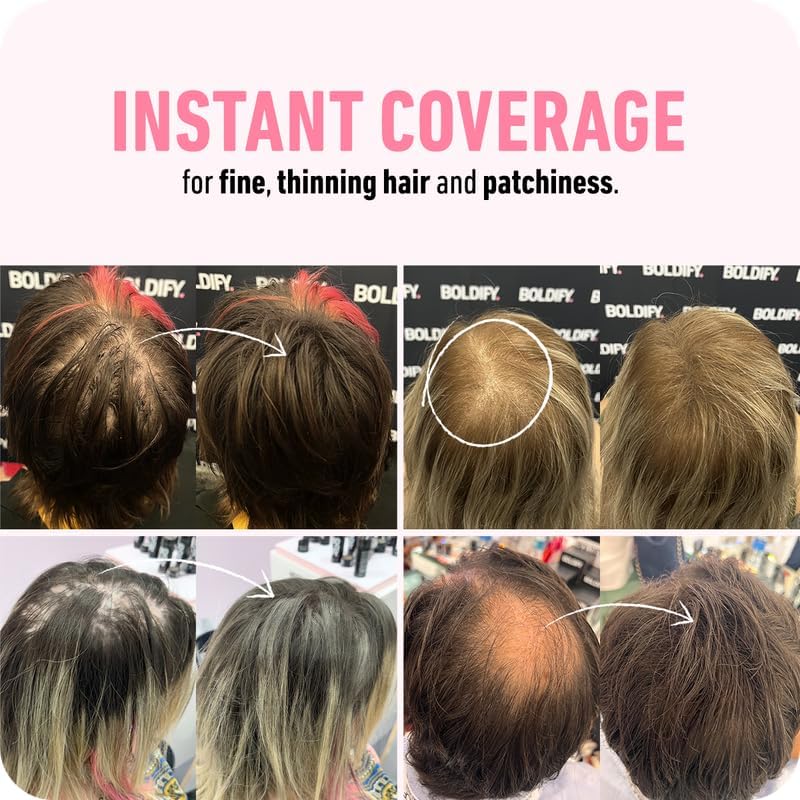 BOLDIFY Undetectable Hair Fibers for Thinning Hair (Dark Brown) - 12gr Bottle FROM DUBAI(SAM) - View 3 of 6