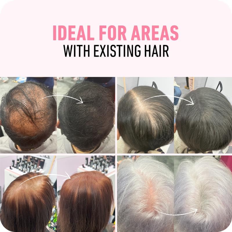 BOLDIFY Undetectable Hair Fibers for Thinning Hair (Dark Brown) - 12gr Bottle FROM DUBAI(SAM) - View 4 of 6