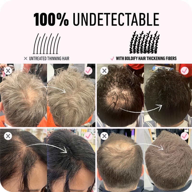 BOLDIFY Undetectable Hair Fibers for Thinning Hair (Dark Brown) - 12gr Bottle FROM DUBAI(SAM) - View 5 of 6