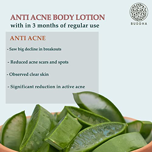 BUDDHA NATURAL Anti Acne Body Lotion (150 ml) - Help Clear Acne and Reduce Future Breakouts - 100% Natural (FROM INDIA)SAB - View 5 of 6