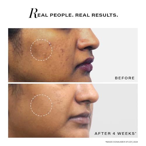 Novology Pigmentation Reduction Sunscreen SPF 30 PA+++ | Sun Protection Face Cream for Dark Spots, Hyperpigmentation(FROM INDIA)JEZ - View 5 of 6