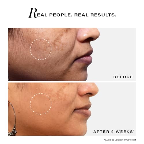 Novology Pigmentation Reduction Serum | Bi-Phasic Face Serum for Dark Spots and Hyperpigmentation | With Niacinamide + Pro-Retinol + Hexylresorcinol(FROM INDIA)JEZ - View 5 of 6