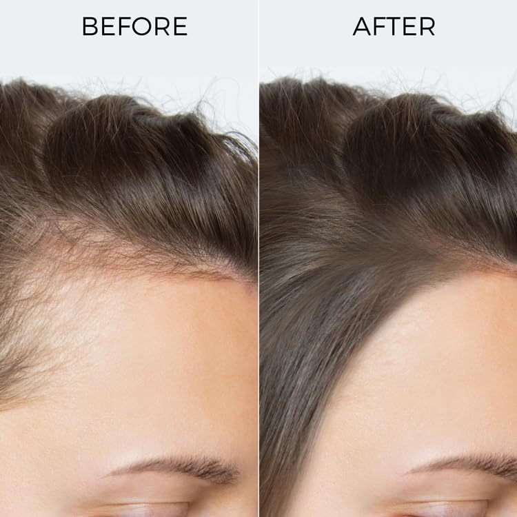 BRILLARE Pure Rosemary Essential Oil For Hair Growth 15 Ml, 70 Grams(FROM INDIA)JEZ - View 5 of 7