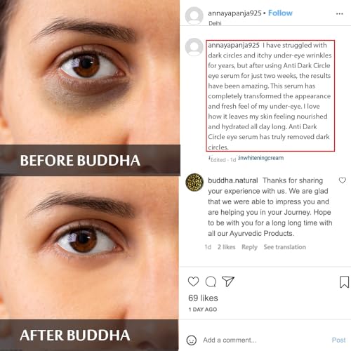 Buddha Natural Dark Circle Eye Serum (10 ml) - Helps Get Bright, Youthful Eyes, Reduces Dark Circles - 100% Chemical-Free(FROM INDIA)JEZ - View 4 of 6