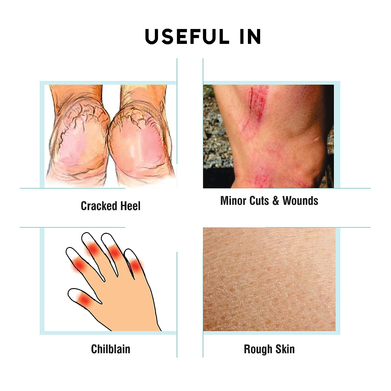 Ban Labs Cutfar Ointment - 25G (Pack of 2) | Cracked Heels repair | Chilblain Cream | foot cream |Cuts & Wounds |Rough Skin| For Cracked & Painful Heels - View 3 of 5