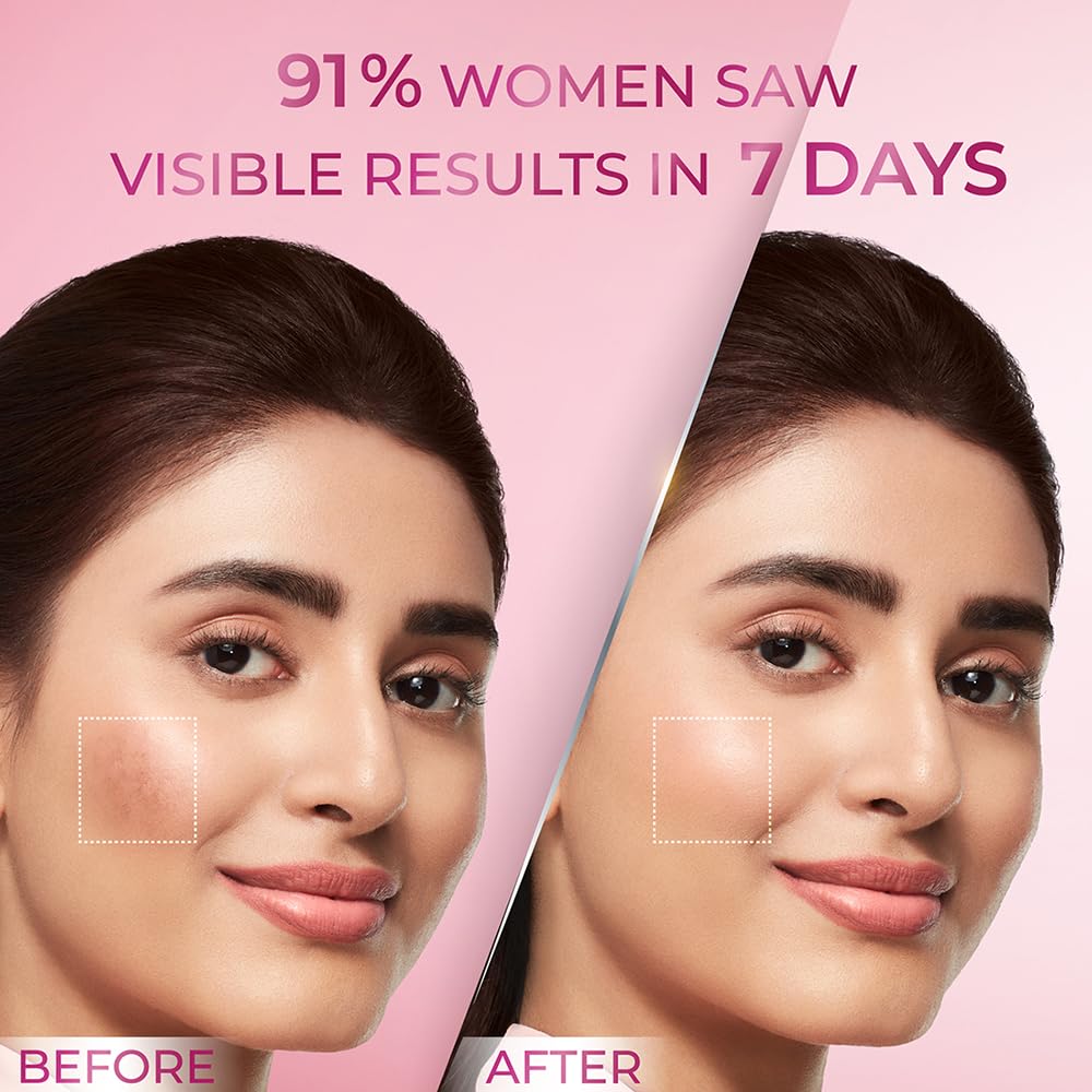 Pond's Bright Beauty Anti-Pigmentation Serum for Flawless Radiance with 12% Gluta-Niacinamide Complex - View 3 of 4