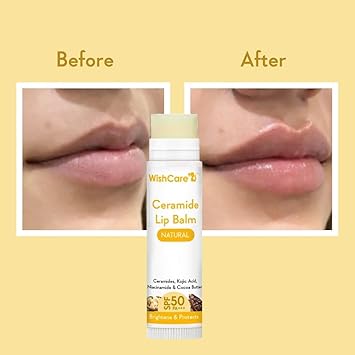 WishCare Lip Balm with SPF 50 PA+++ - Brightening Lip Balm for Dark Lips with Kojic Acid & Niacinamide - SPF lip balm for Women & Men 5g - View 4 of 4