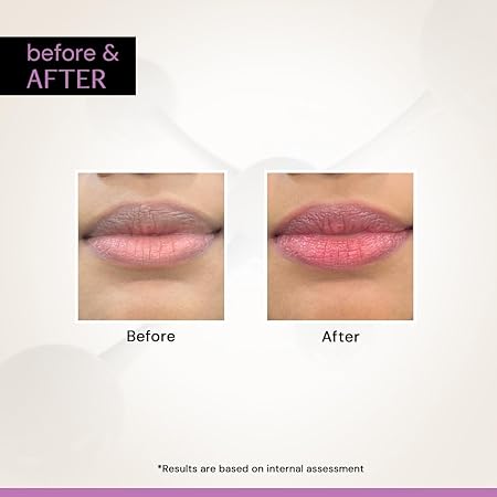 construct Brightening Tinted Lip Balm with SPF 30, for Dark, Pigmented, Dry, Flaky Lips, Protects Against Sun Damage & Discoloration, Glossy Buttery Soft Pink Finish, for Women & Men (4 g) - View 2 of 4