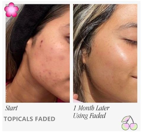 TOPICALS FADED Serum Vegan, Gluten-Free and Cruelty-Free- 1.7OZ/50ML(NEW VERSION) - View 4 of 4