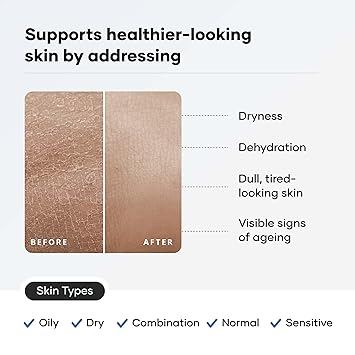 Cureskin Ceramide Moisturiser SPF 40 PA+++ – Skin Barrier Repair Face Moisturizer for Men & Women With Hyaluronic Acid Anti-Aging Face Cream - View 2 of 4