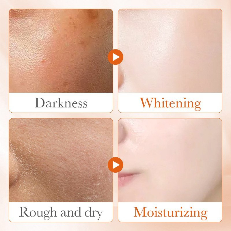 SADOER 5X Vitamin C Face Serum 30ml (SD08084) 1PCS, Brightening Anti-Aging Facial Serum, Dark Spot Correcting, Hydrating, Revitalizing, Lightweight Daily Skincare Solution for Radiant, Smooth, and Healthy-Looking Skin - View 2 of 3