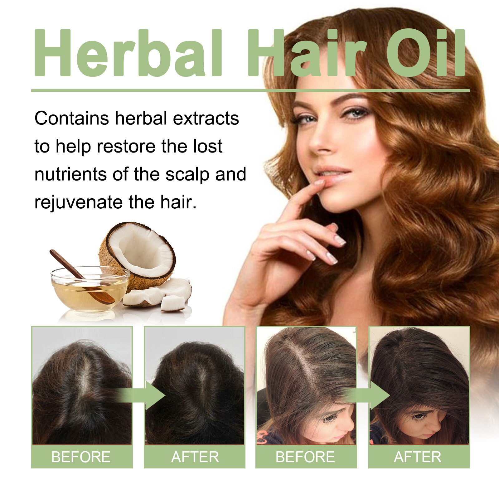 Ouhoe Hair Care Oil Nourishes Scalp Strengthens Hair Promotes Growth Hair Care 100ml- 2pcs【Beli 1 ambil 1】(FROM MALAYSIA) - View 4 of 4