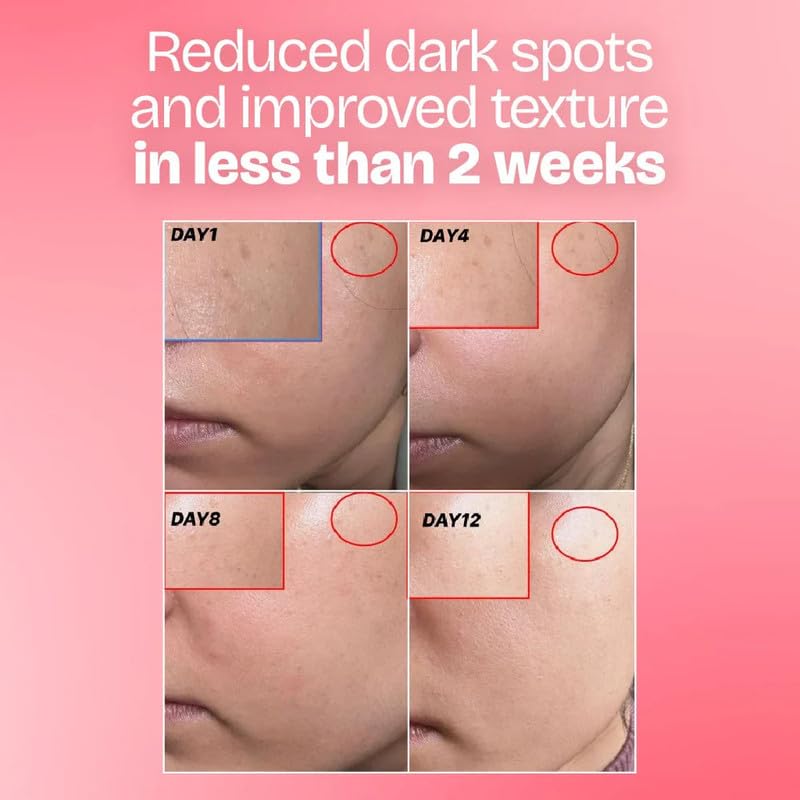 Korean Glow Combo for Face | Microcapsule Moisturizer + Glow Serum | 8-Complex Hyaluronic Acid | 5% Niacinamide + 1% Tranexamic Acid | Dark Spots, Acne Marks & Glass Skin Hydration - View 3 of 5