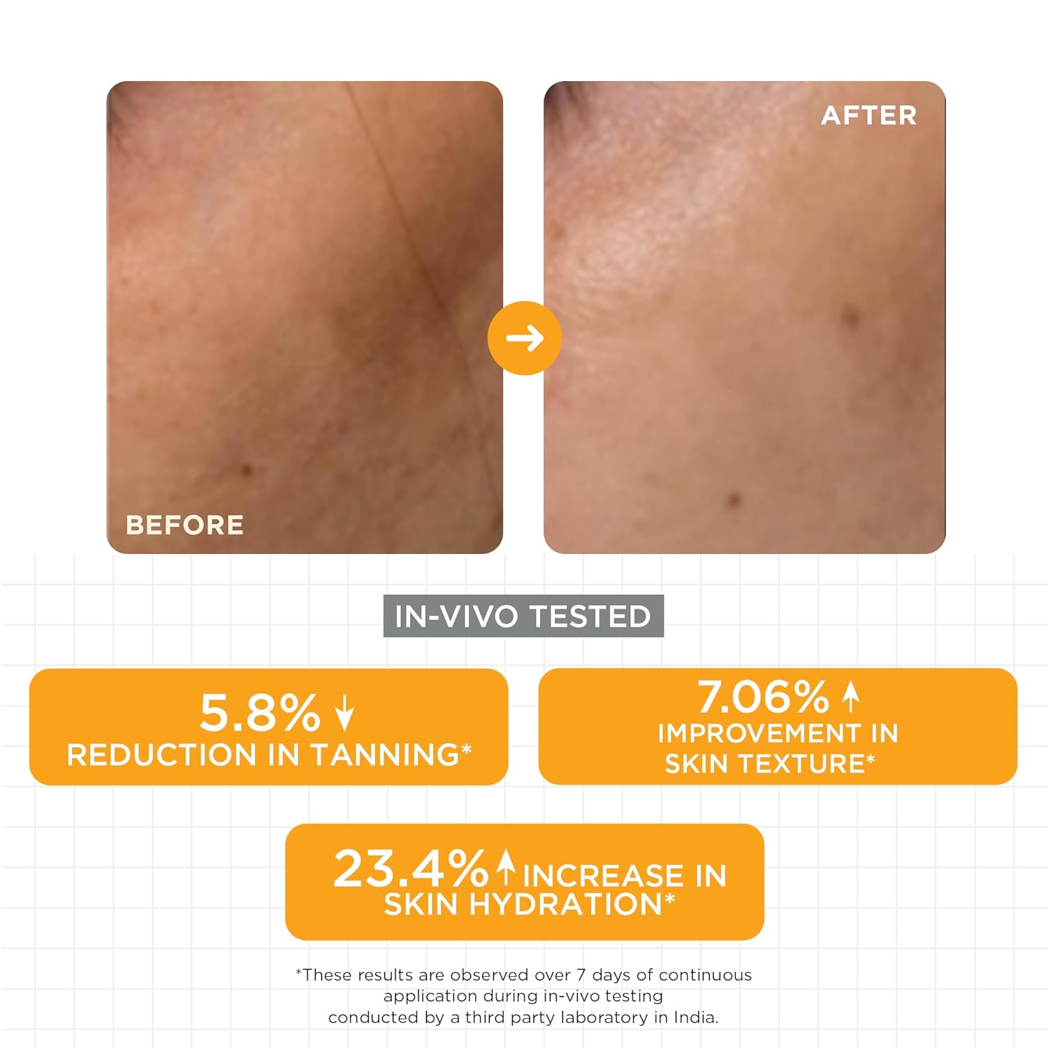 SkinQ 15% Vit C Face Serum for Glowing & Brightening Skin (20 ml) | Helps reduce Pigmentation, Patches, Dark Spots & Tan | Glow Serum for Men & Women with All Skin Types | Lightweight & Non-drying - View 4 of 5