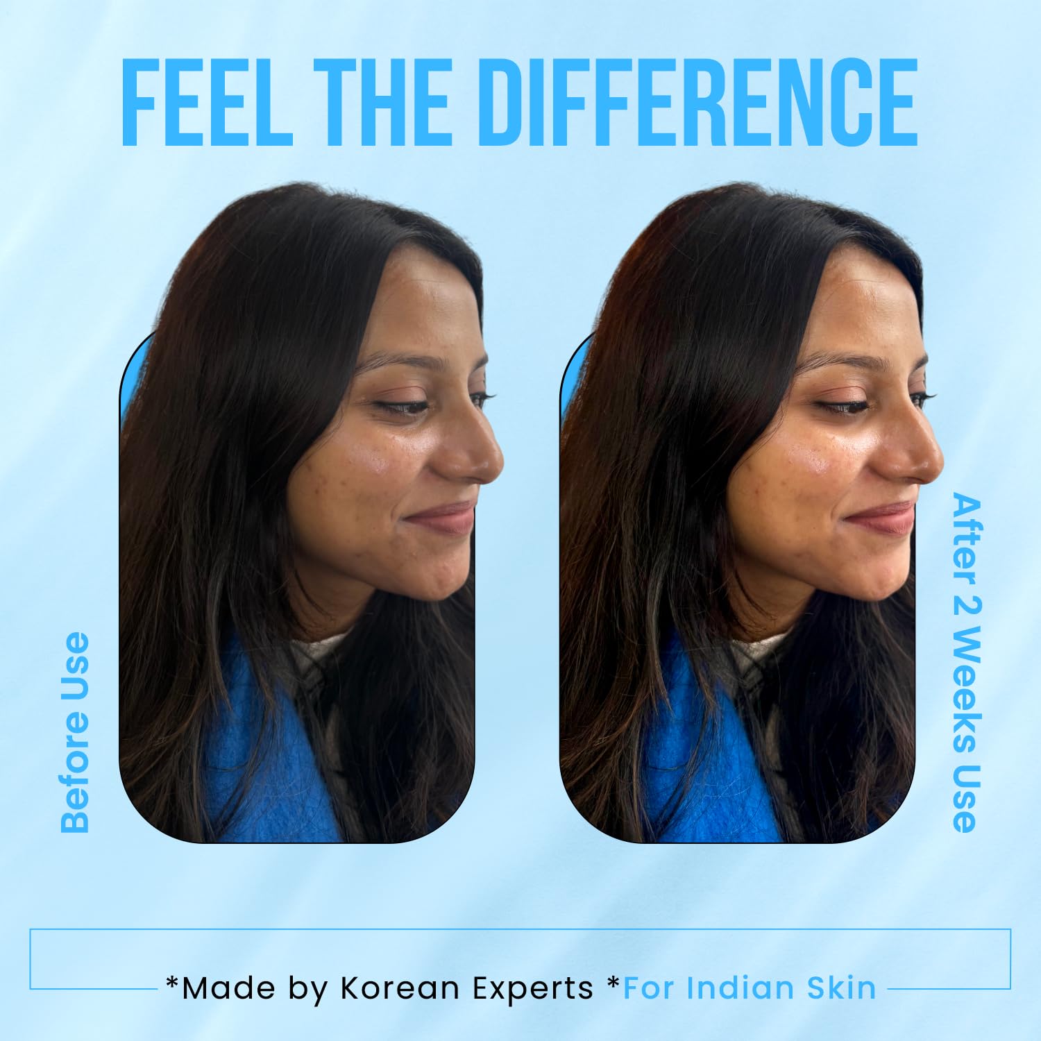 ISLAND Dewdrop Korean Rice Water Brightening Serum | Evenness Boost with 50% Rice Water, 2% Niacinamide, 2% Turmeric | Fades Dark Spots & Pigmentation | Hydrating Glass Skin for All Skin Types | 30ml - View 2 of 4