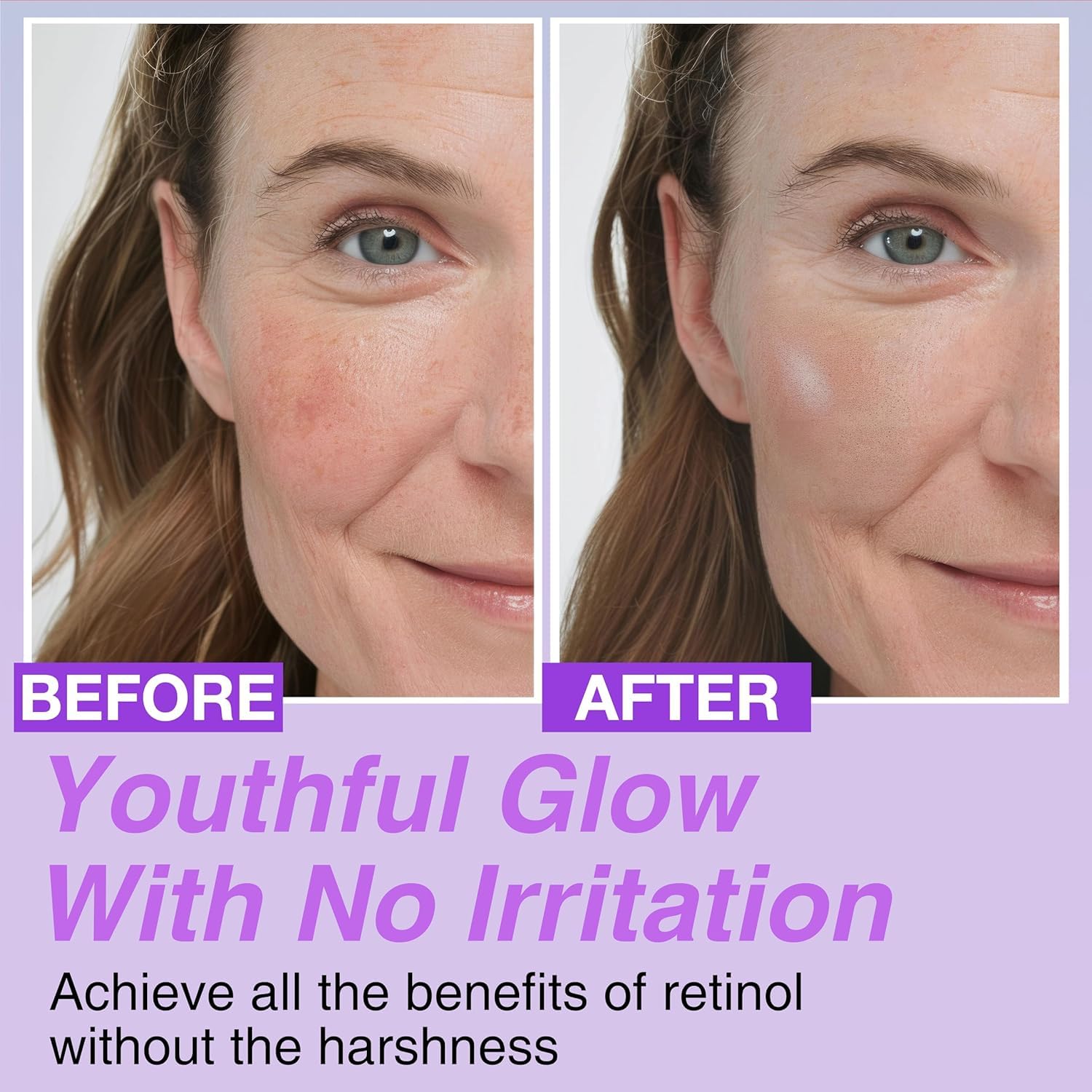 Korean Bakuchiol Concentrate DIY Mix-in Serum 30,000 ppm - High Potency Retinol Alternative | Wrinkle Reduction Skin Firming & Smoothing - Anti-Aging Sensitive Skin Vegan & Cruelty-Free Non-GMO - 30ml - View 4 of 5