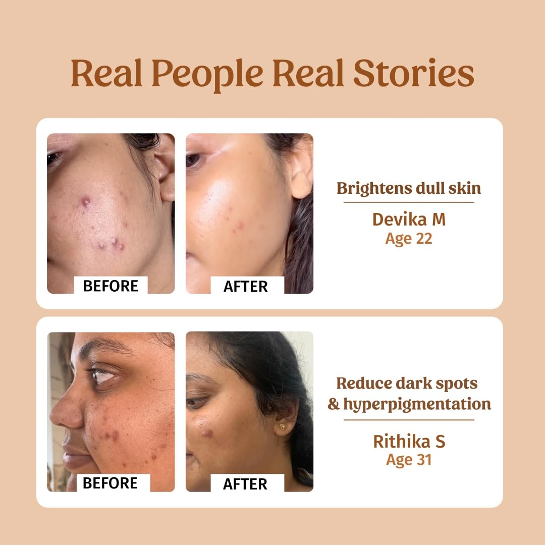 Vilvah Milk Drops Brightening Face Serum | Helps Reduce Dark Spots, Pigmentation & Acne Scars | Hydrates & Improves Skin Tone | With Alpha Arbutin & Hyaluronic Acid | For All Skin Types | 40ml - View 4 of 6