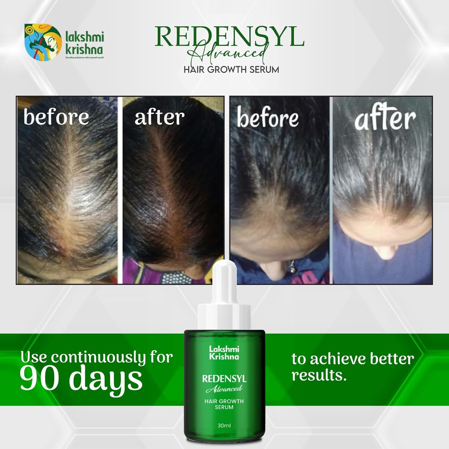 Lakshmi Krishna Naturals Advanced Hair Growth Serum 30 ml with Redensyl 3%, Anagain 4%, Baicapil 2% & Caffeine – Plant Based Serum to Stimulate Hair Regrowth, Support Hair Density & Scalp Care for Men & Women - View 3 of 6