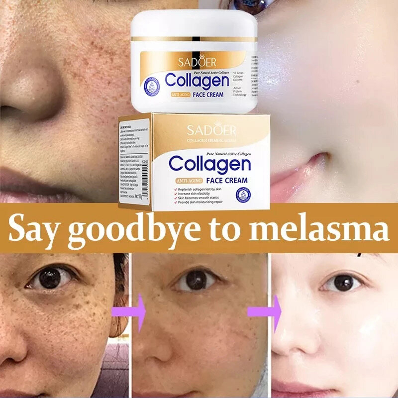 Sadoer Whitening & Freckle Moisturizing Cream 100g Collagen Anti-Aging Anti-Wrinkle Dark Spot Removal Melasma Pore Care Brightening Hydrating Face Cream Glowing Skin Freckle Reducing Gentlewoman Skincare - View 2 of 3