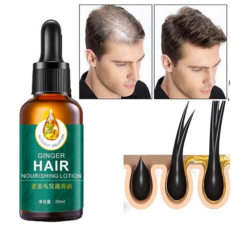 serum rambut gugur Hair Growth Essential Oil Hair growth serum hair loss improve hair follicles 頭發營養水精油生發液(FROM MALAYSIA) - View 4 of 4