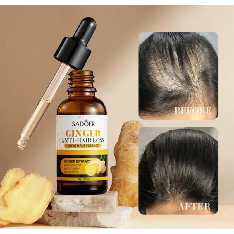 Original Ginger Hair Serum – Boosts Hair Volume and Promotes Hair Growth-Nutrition(FROM MALAYSIA) - View 2 of 4