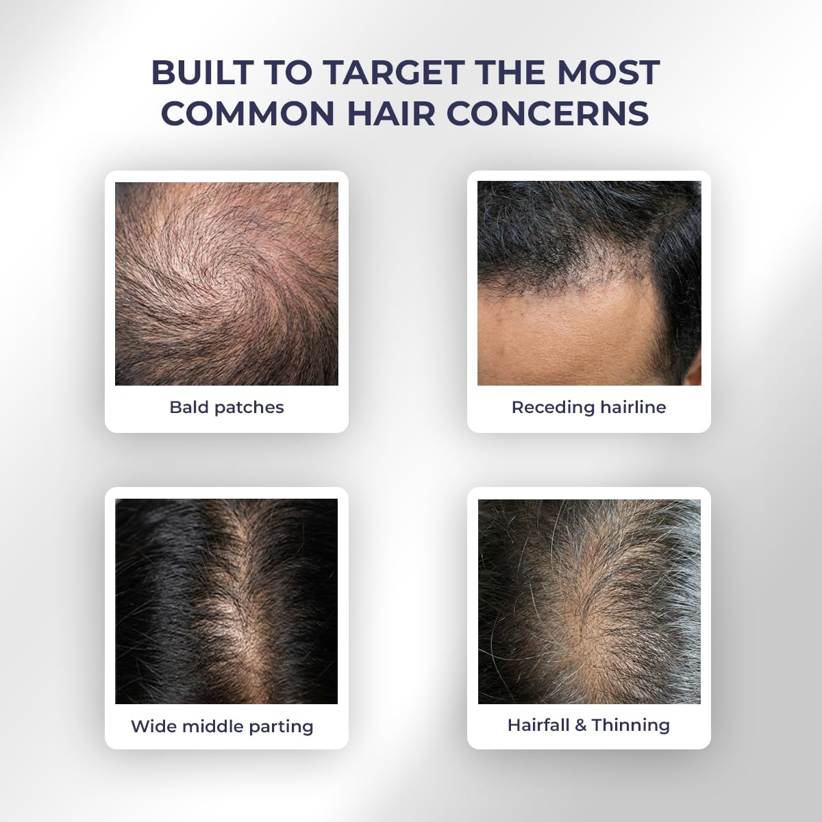Conscious Chemist® Full Strength Hair Growth Oil | Rosemary, Red Onion & Moringa | With Yeast Extract | 14 Oil Complex | Reduces Hair Fall, Nourishes Scalp & Promotes Hair Growth | For All Hair Types | Women & Men | 100ml - View 6 of 6