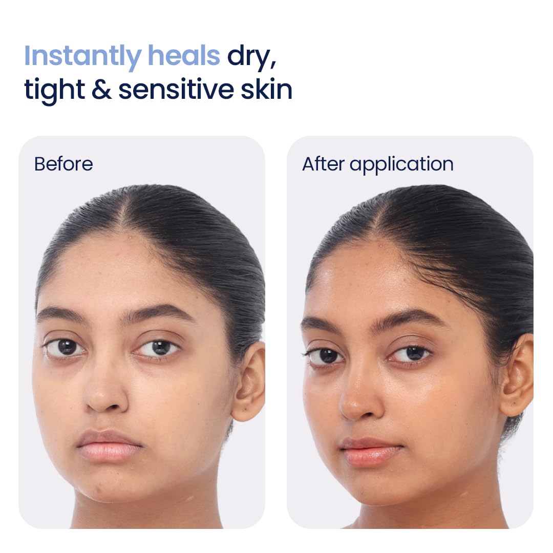 WishCare 3:1:1 Barrier Bounce Moisturizer Cream for Face | Barrier Repair Moisturizer With Ceramides, EGF & Mung Mucin | Repairs Skin Barrier, Calms & Soothes | For Dry Skin, Oily & Combination Skin | For Men and Women | 50ml - View 4 of 5
