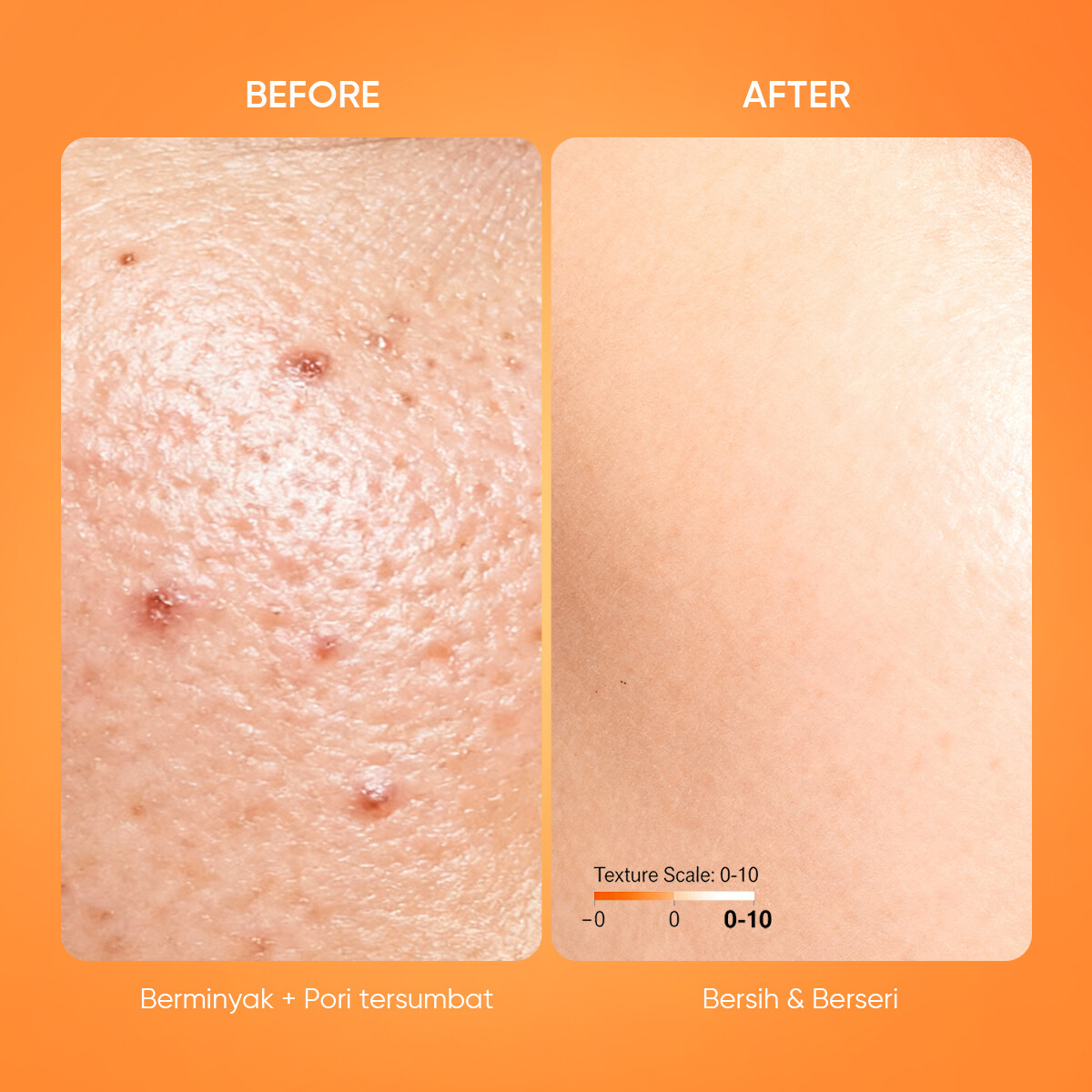 GMEELAN Orange Enzymes Exfoliating Brightening Gel 50g Vitamin C French Enzymes Blood Orange Jojoba Oil Plant Fibre Fast Exfoliation Blackhead Removal Acne Control Pore Refining Skin Care - View 3 of 3