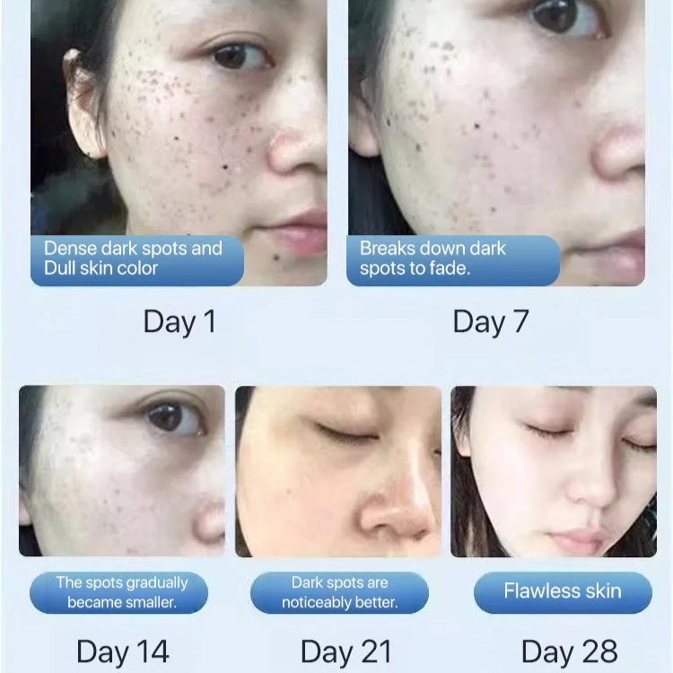 Whitening Facial Cleanser Anti Mite Oil Control Exfoliating Face Wash Deep Cleaning Brightening Anti Freckle Skin Purifying Cleanser for Smooth Clear Radiant Complexion Daily Skincare Solution - View 2 of 3