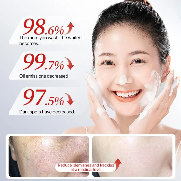 Whitening Facial Cleanser Anti Mite Oil Control Exfoliating Face Wash Deep Cleaning Brightening Anti Freckle Skin Purifying Cleanser for Smooth Clear Radiant Complexion Daily Skincare Solution - View 3 of 3