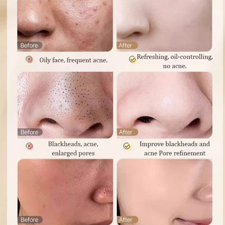Whitening Spot Removal Facial Cleanser Anti Acne Anti Freckle Oil Control Deep Cleansing Brightening Face Wash Pore Purifying Skin Care Smooth Even Tone Daily Facial Cleanser - View 3 of 3