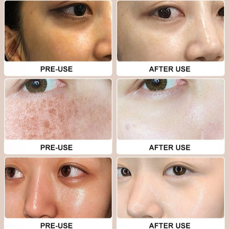 Deep Cleansing Whitening Facial Foaming Cleanser 100g Niacinamide Face Wash Oil Control Blackhead Removal Cleansing Milk Brightening Hydrating Smooth Skin Gentle Daily Skincare Facial Foam Cleanser Radiant Glow Care - View 2 of 3
