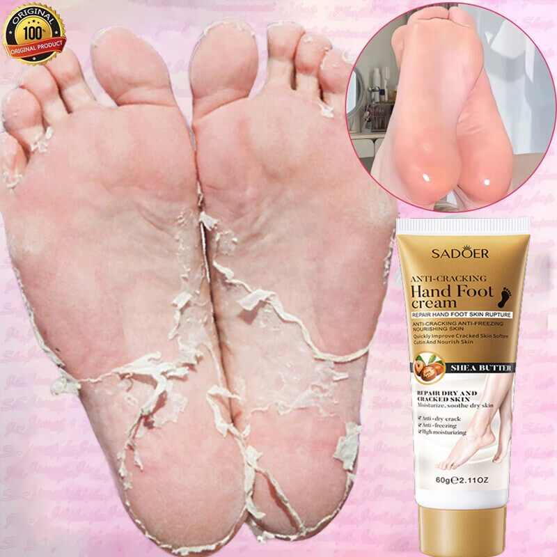 Moisturizing Anti-Freeze Heel Foot Cream 60g Repair Cracked Heels Dry Skin Treatment Hand Foot Care Prevent Dryness Itching Frostbite Protection Deep Hydration Smooth Skin Daily Use - View 2 of 3