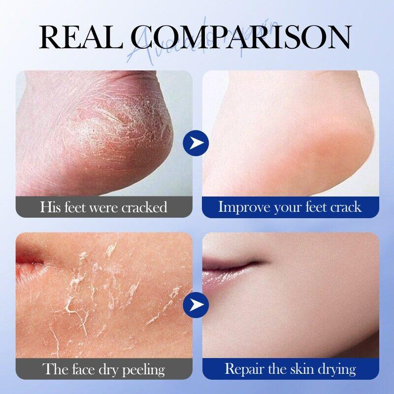 Moisturizing Anti-Freeze Heel Foot Cream 60g Repair Cracked Heels Dry Skin Treatment Hand Foot Care Prevent Dryness Itching Frostbite Protection Deep Hydration Smooth Skin Daily Use - View 3 of 3