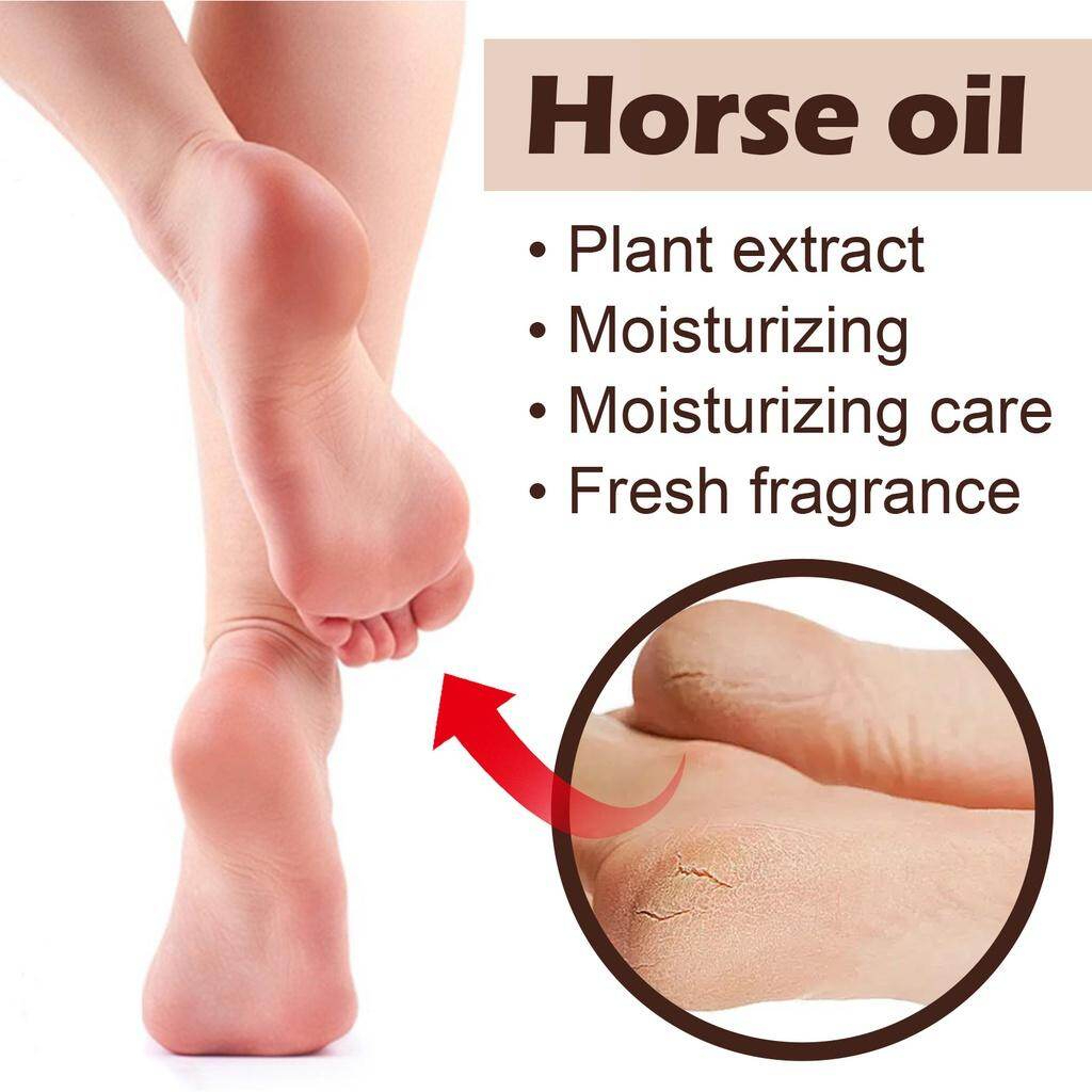 Foot Treatment Cream Anti-Cracking Moisturizing Foot Care Repair Dry Cracked Skin Anti-Dryness Anti-Chapping Deep Hydration Softening Heel Care Daily Use Smooth Skin Recovery Balm - View 3 of 3