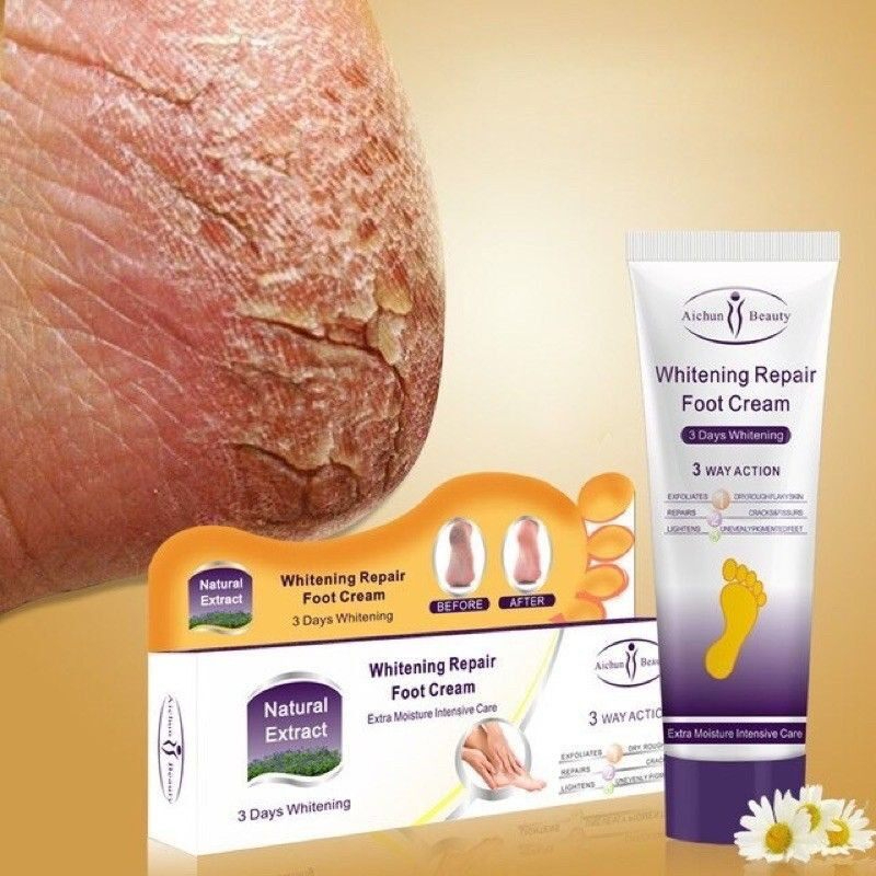 Aichun Beauty Perfect Care Feet Cream Moisturizing Whitening Repair Anti-Crack Foot Cream Deep Hydration Softening Rough Dry Skin Heel Care Brightening Smooth Skin Daily Use - View 2 of 3