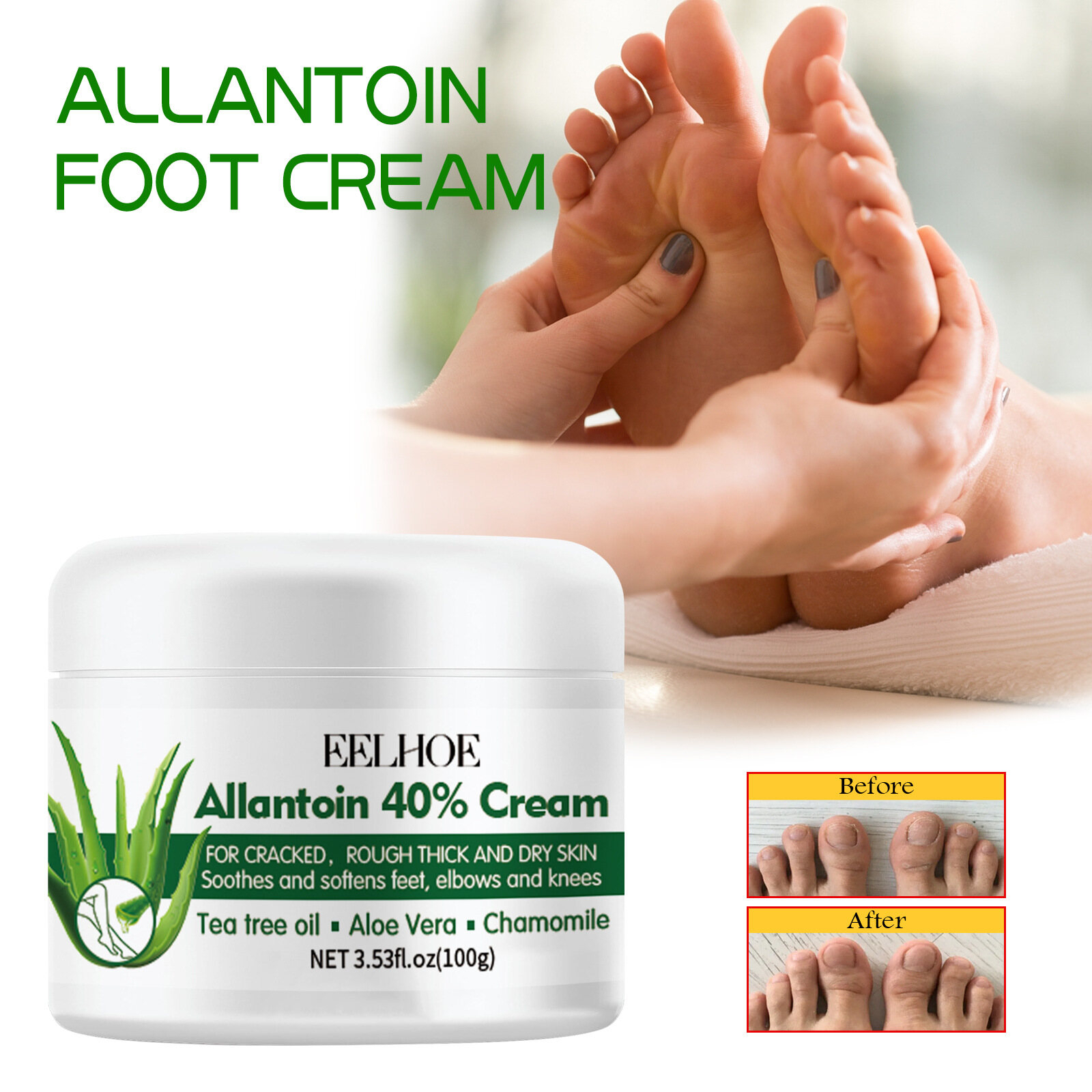 Eelhoe Anti-Drying Crack Foot Cream Exfoliating Heel Repair Remove Dead Skin Calluses Moisturizing Anti-Crack Treatment Peeling Care Smooth Soft Feet Hydration Daily Use Foot Mask - View 2 of 2