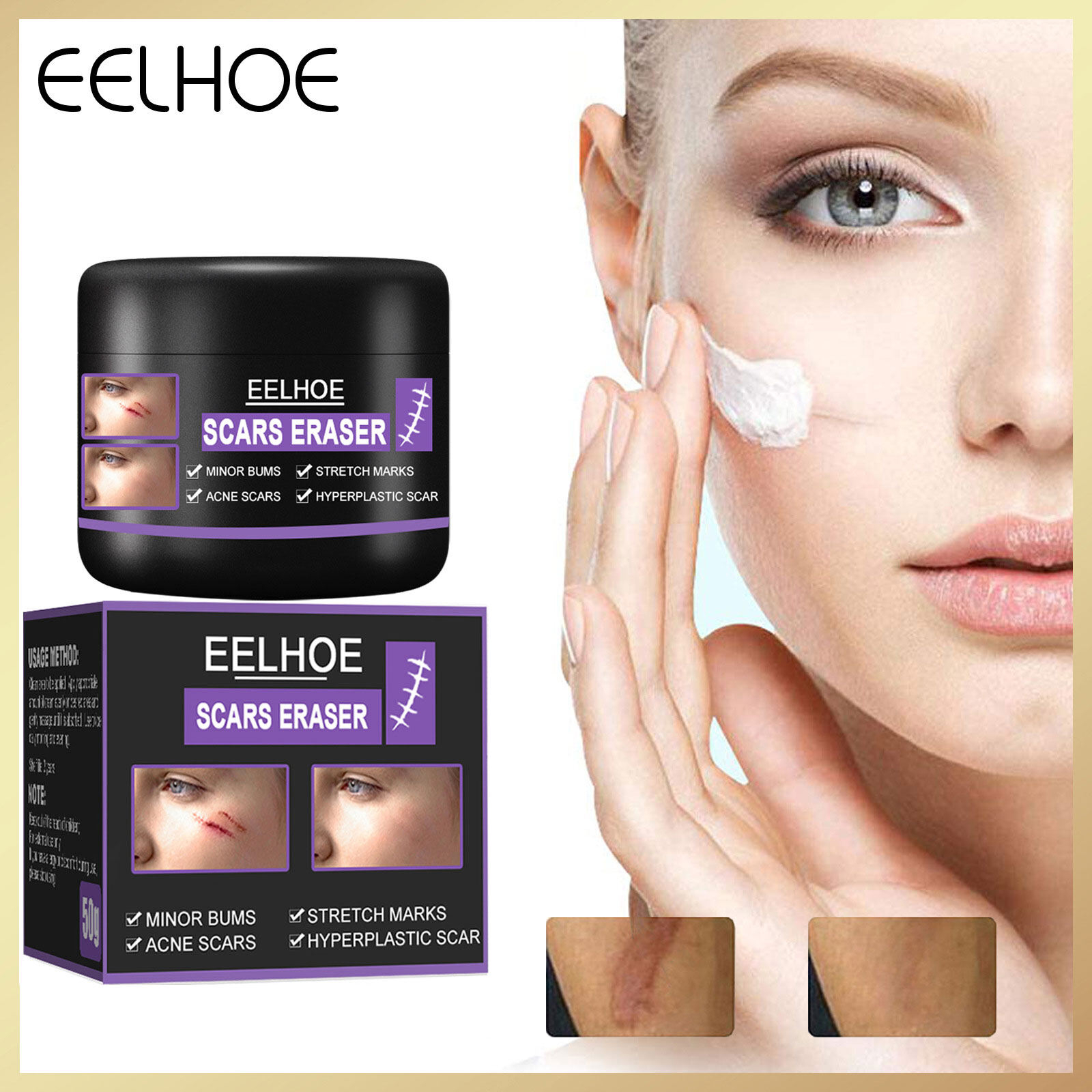 Eelhoe Scar Removal Cream Silicone Gel Repair Skin Scars Treatment Surgical Scars Stretch Marks Acne Pox Burn Marks C-Section Scar Repair Moisturizing Whitening Body Care Daily Use Formula Fast Absorption - View 2 of 3