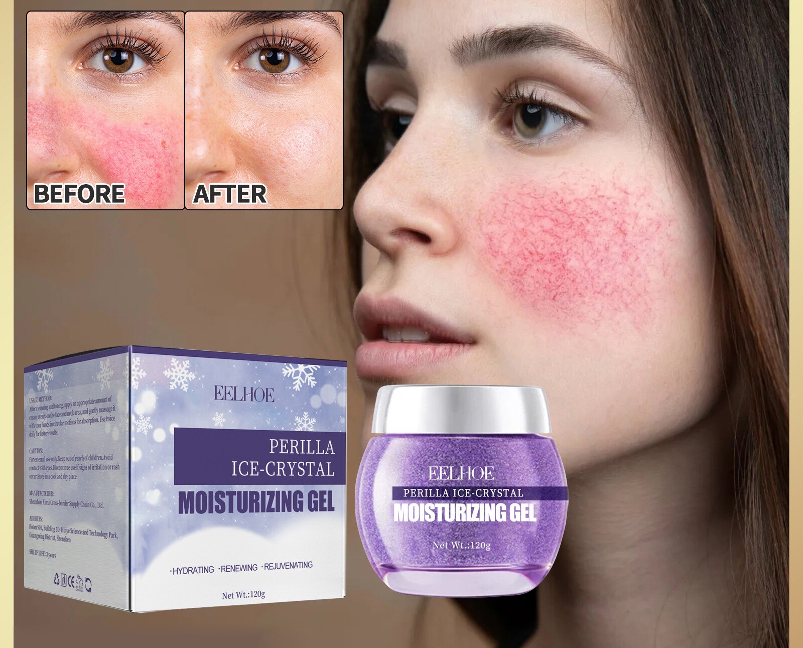 Eelhoe Acne Treatment Gel Acne Whitening Fade Dark Spots Reduce Blackheads Facial Redness Soothing Repair Pimple Moisturizing Deep Cleaning Oil Control Shrink Pores Anti Acne Skin Care Face Gel - View 2 of 2