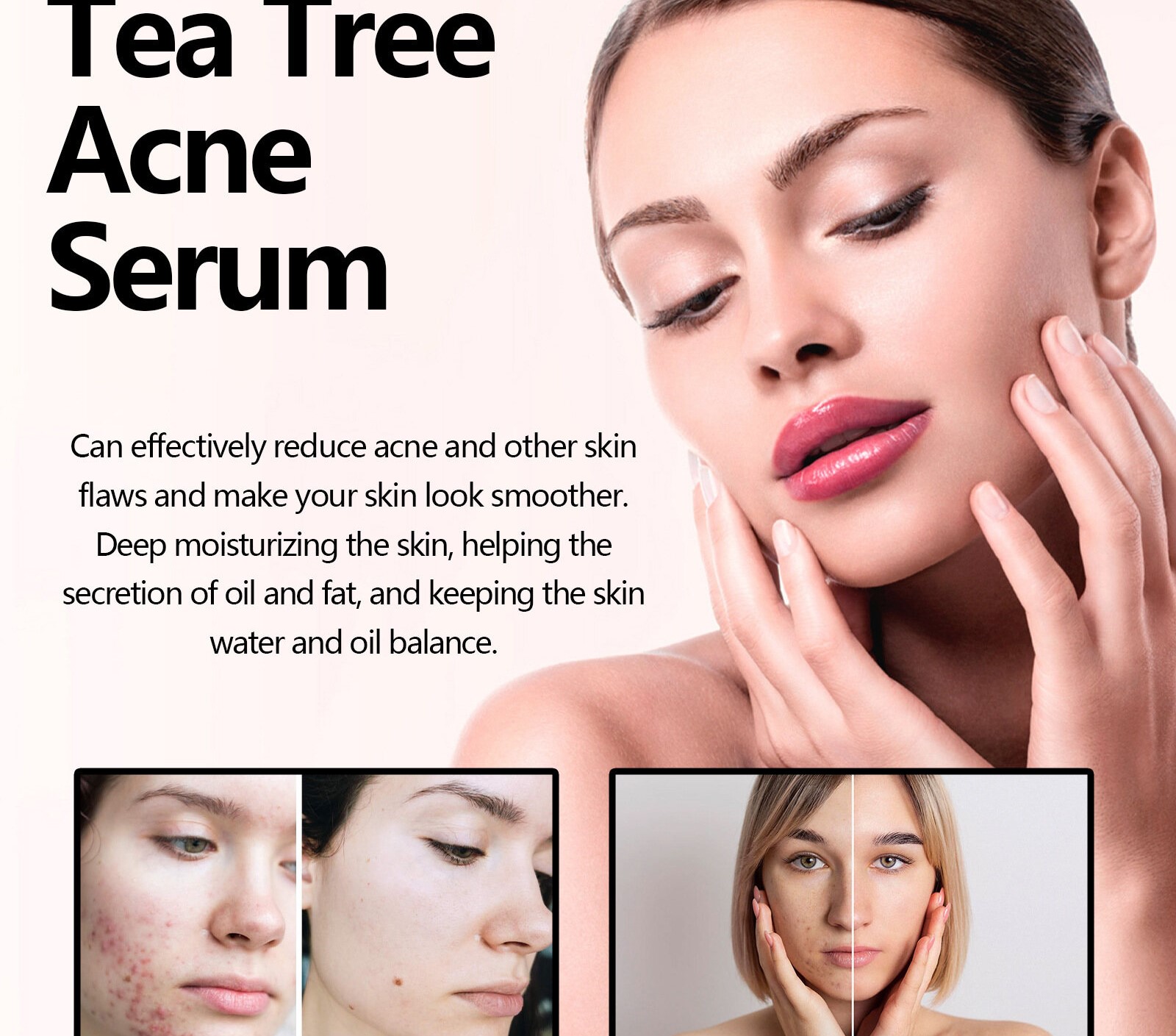 Eelhoe Tea Tree Acne Serum 30ml Pore Minimizing Anti Acne Treatment Reduces Pimples Spots Brightens Skin Hydrating Anti Aging Wrinkle Care Lightweight Facial Serum - View 2 of 3