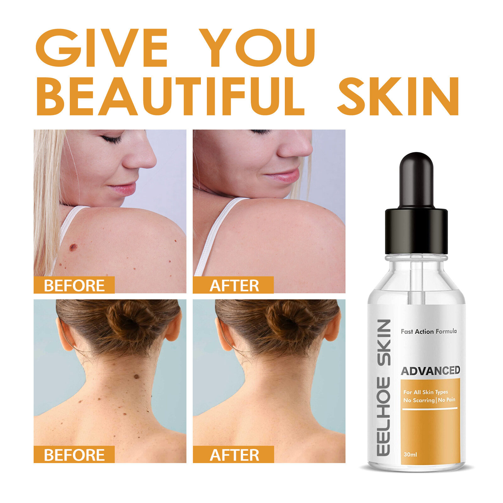 Eelhoe Wart Removal Serum Mole And Wart Essence Skin Face Armpit Meat Neck Removal Repair Cleansing Care Universal Skin Mole Removal Essence Wart Solution Portable Lighten Melanin - View 2 of 3