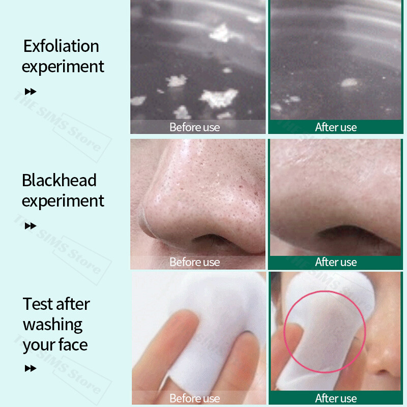 SOME BY MI AHA BHA PHA 30 Days Miracle Toner 150ml Acne Treatment Exfoliating Pore Care Soothing Hydrating Oil Control Brightening Anti Acne Scar Korean Skincare - View 2 of 3
